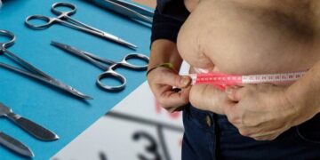 Кентауда алғаш рет бариатриялық ота сәтті жүзеге асырылды